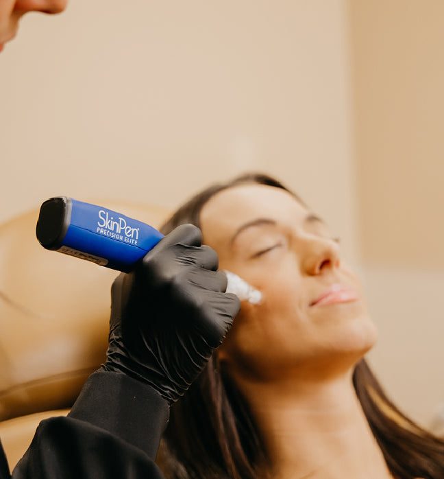 Microneedling