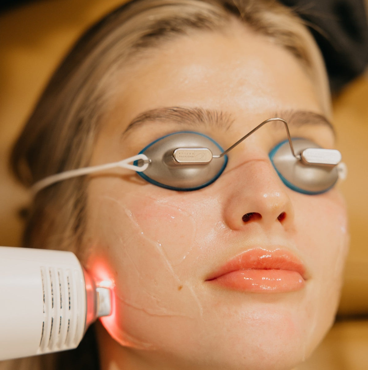 A Looksmaxxing Guide to Laser & Energy Treatments