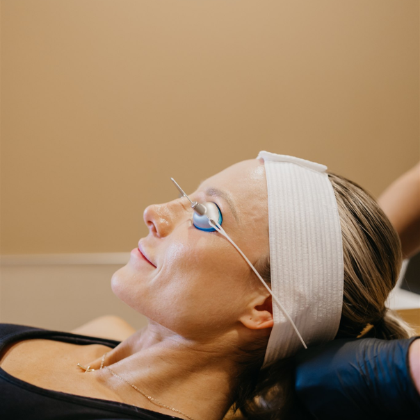 Microblading Removal: Why Lasers Are the Gold Standard for Fixing Bad Brows