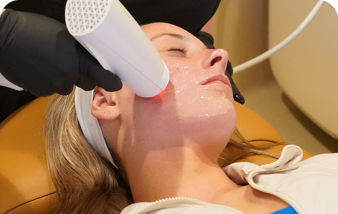 Woman receiving a laser treatment on her face in a clinical setting.