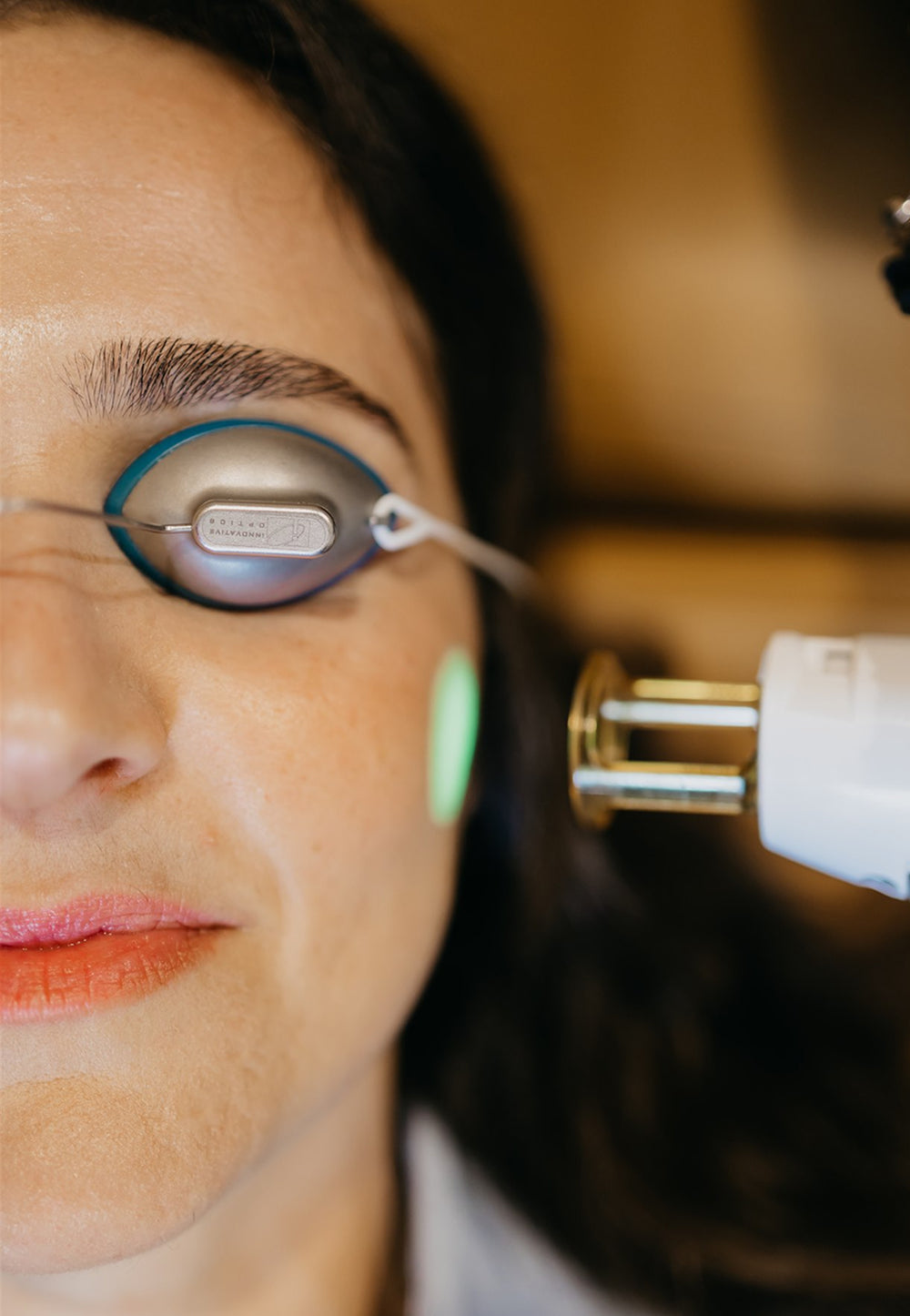 Close-up of a person receiving laser treatment on their face with a blurred background
