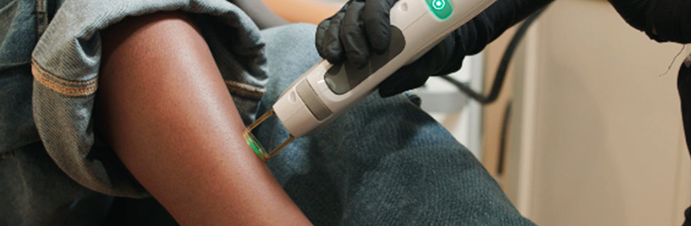 A close-up of a person's shin receiving a laser treatment, with a gloved hand holding a handheld device against the skin.