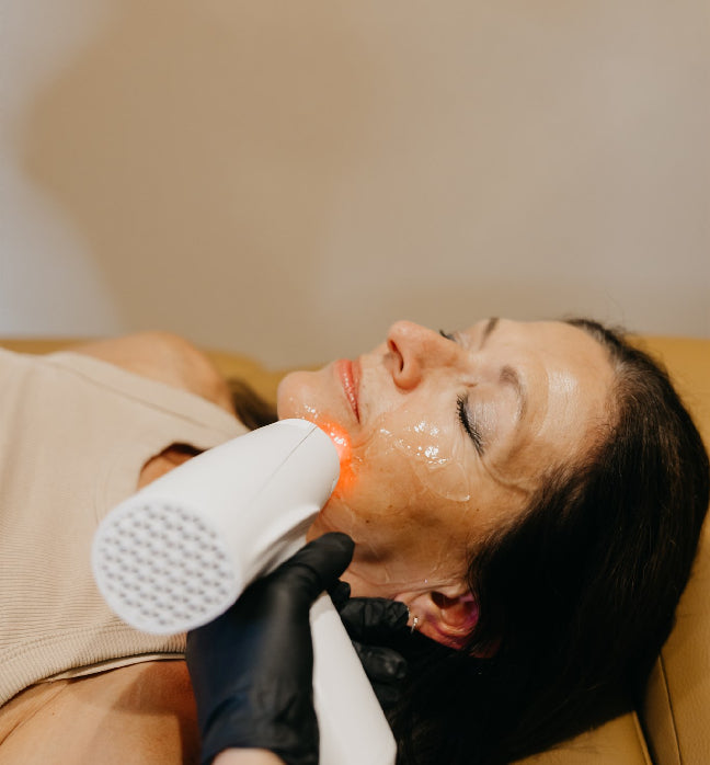 Person receiving a microneedling treatment on their face.