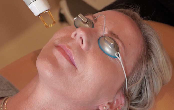 Woman receiving a photofacial treatment 