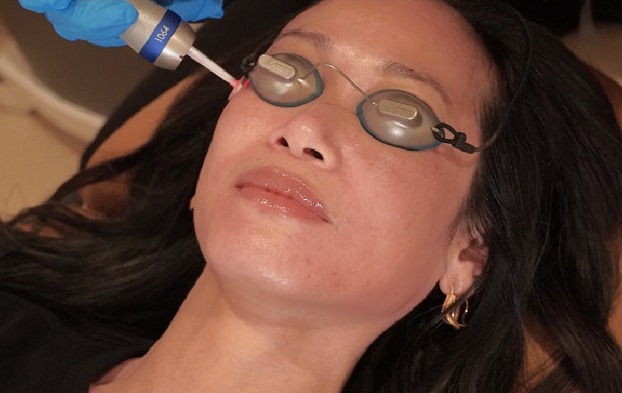 Person receiving a cosmetic procedure with goggles on their eyes