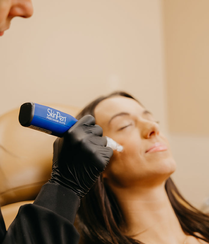 Woman receiving SkinPen treatment