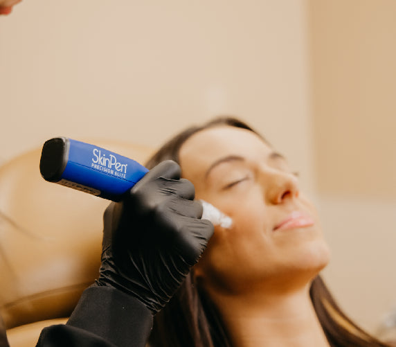 Woman receiving Skinpen Microneedling treatment on face