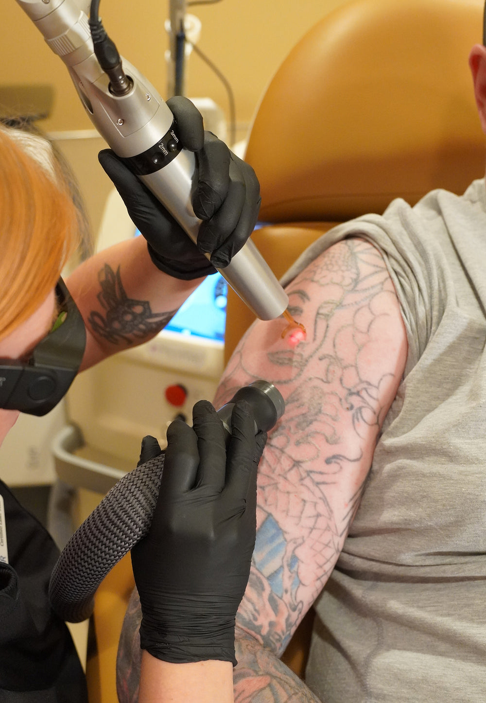 Person receiving laser tattoo removal on their arm.