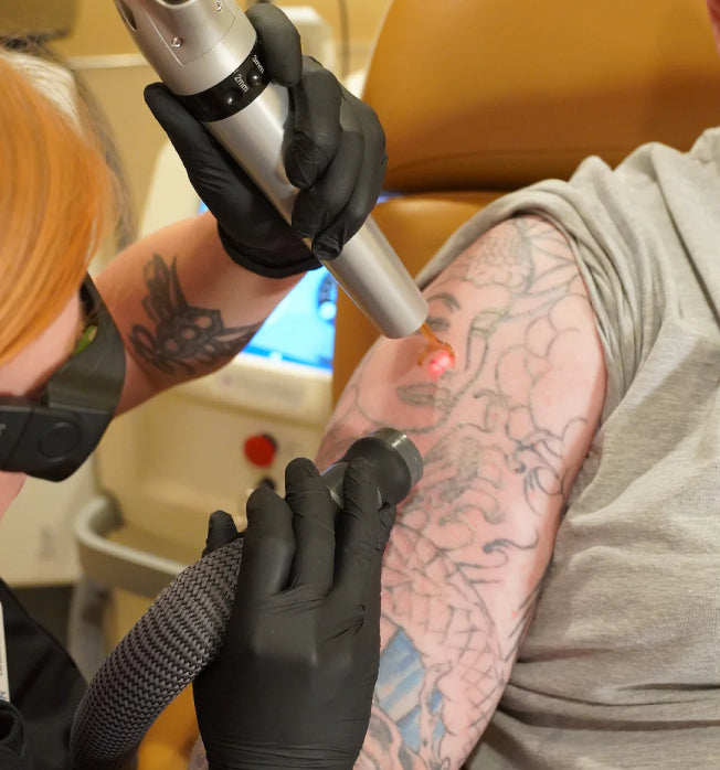 Person receiving laser tattoo removal on their arm.