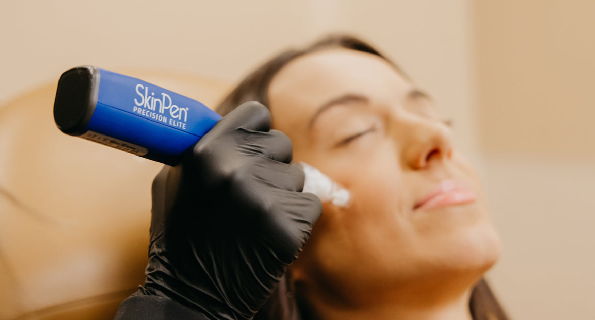 Person receiving a SkinPen treatment on their face with a blurred background